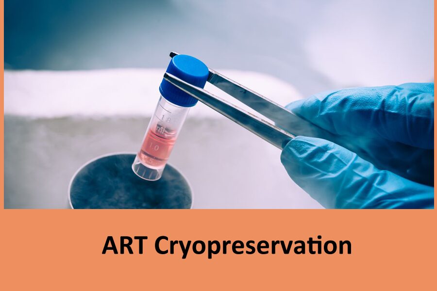 ART Cryopreservation